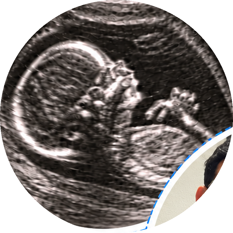 Imagem de ultrassom do bebê João Benício